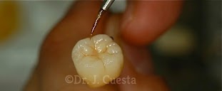 Clínica Dental Implantologia Estética Dr. Cuesta en Bilbao