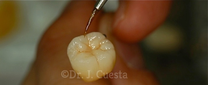 Clínica Dental Implantologia Estética Dr. Cuesta