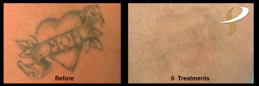 Explore back tattoo ideas men, creative tattoo ideas in Spokane, available at Premier Body and Laser