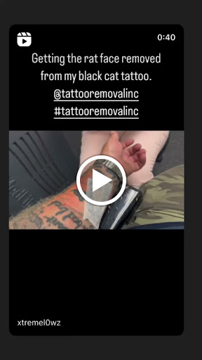 Explore oktoberfest tattoo ideas, creative tattoo ideas in South Gate, available at Tattoo Removal Inc