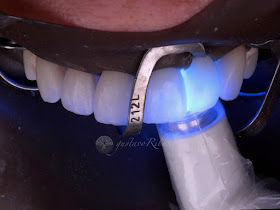 GR Odontologia - Dr. Gustavo Ribas