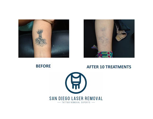 Explore patriotic forearm tattoo ideas, creative tattoo ideas in San Diego, available at Removery Tattoo Removal & Fading