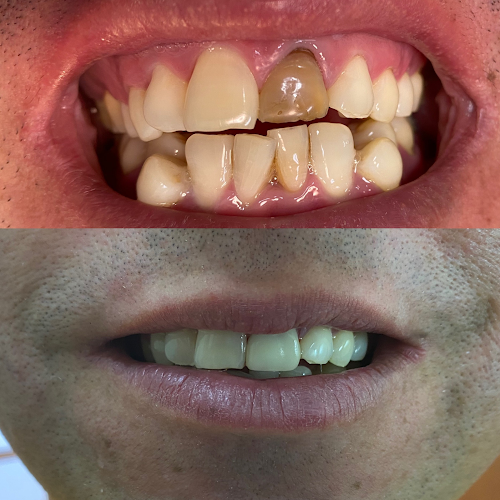 Clínica dental Salud Oral linares - Linares