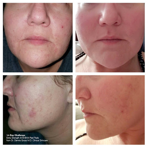 Explore illenium tattoo ideas, creative tattoo ideas in Glastonbury, available at Sarah Victor Studios