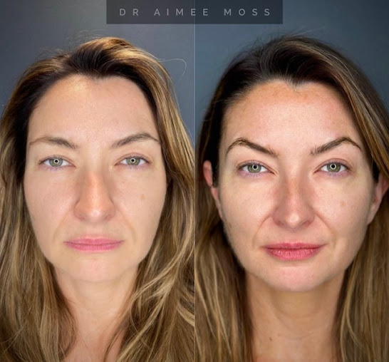 الدكتور ايمي موس - Dr Aimee Moss