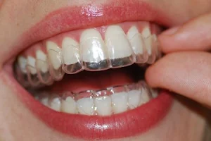 Studio Dentistico - Confident | Torvaianica image