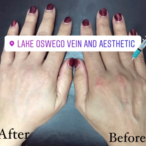 Explore great shoulder tattoo ideas, creative tattoo ideas in Lake Oswego, available at Lake Oswego Vein and Aesthetic LOVA