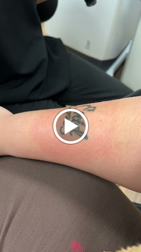 Explore dog outline tattoo ideas, creative tattoo ideas in Newtown, available at Removery Tattoo Removal & Fading