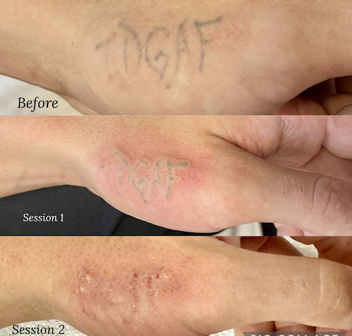 Explore atlantis tattoo ideas, creative tattoo ideas in Savannah, available at Haute Brows. Cosmetic Tattoo