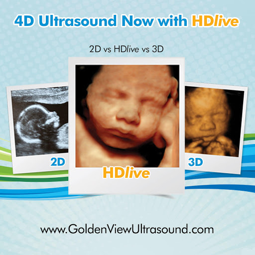 Goldenview Ultrasound 3d/4d/HD San Antonio