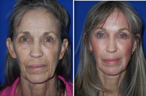 Medical Spa «Enhanced Image Med Spa», reviews and photos, 7942 W Bell Rd #2, Glendale, AZ 85308, USA