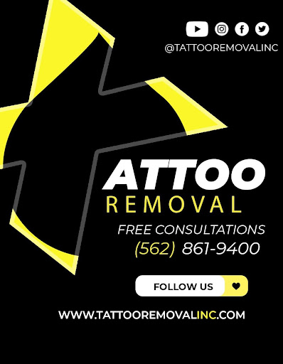 Explore 3/4 sleeve tattoo ideas, creative tattoo ideas in South Gate, available at Tattoo Removal Inc
