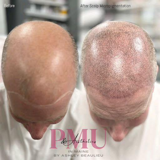 Explore tattoo ideas to cover scars, creative tattoo ideas in Lewiston, available at Permanent Makeup & Aesthetics In Maine