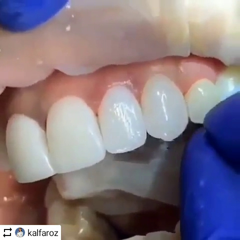 BLAUZ Clínica Odontológica y Estética - Dentista