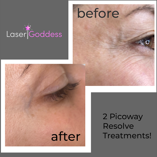 Explore warriors tattoo ideas, creative tattoo ideas in Bayside, available at Laser Goddess