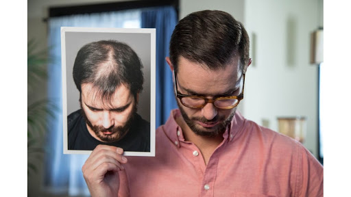 Hair Transplantation Clinic «Bosley Medical - Kansas City», reviews and photos, 460 Nichols Rd #350, Kansas City, MO 64112, USA