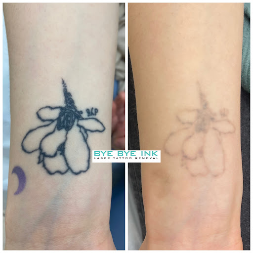 Explore father and son tattoo ideas, creative tattoo ideas in Middle Village, available at Bye Bye Ink Laser Tattoo Removal