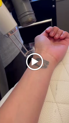 Explore tattoo cover up ideas on hand, creative tattoo ideas in Reno, available at Reno Tattoo Removal