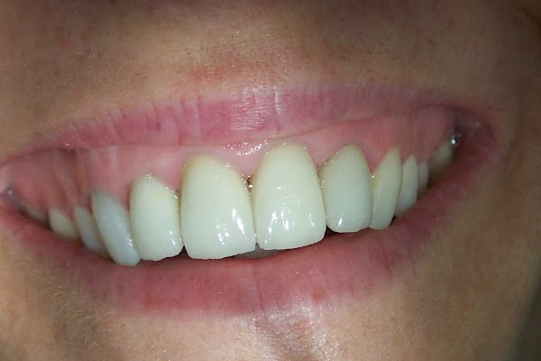 clinica dental arrigorriaga