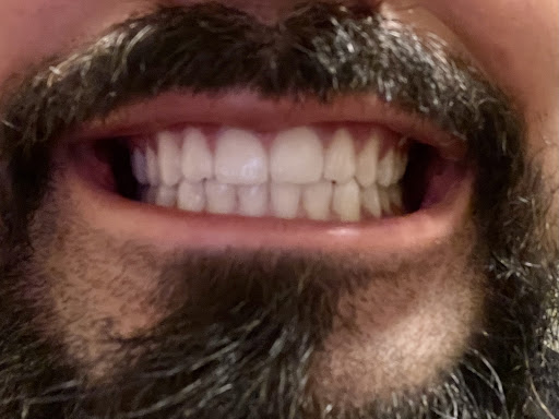 The Perfect Smile image