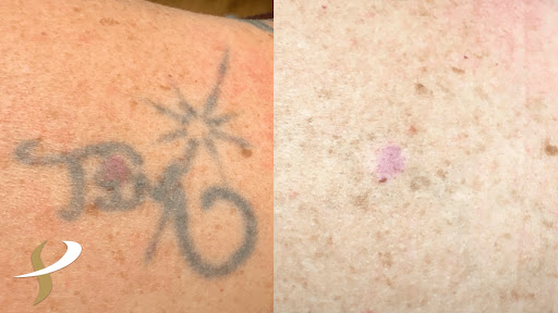 Explore greek tattoos ideas, creative tattoo ideas in Spokane, available at Premier Body and Laser