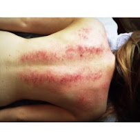 Japanese Acupuncture - Photo 9 - Car repair in Austin, TX, Austin