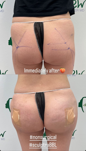 Explore river tattoo ideas, creative tattoo ideas in El Monte, available at Anew Laser MD