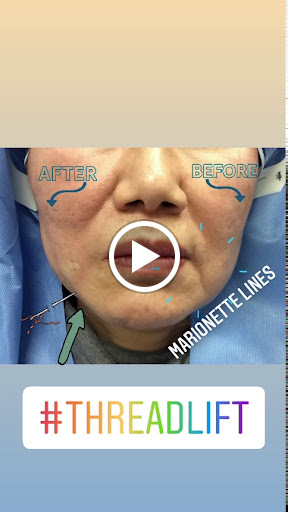 Explore fearless tattoo ideas, creative tattoo ideas in Lake Oswego, available at Lake Oswego Vein and Aesthetic LOVA