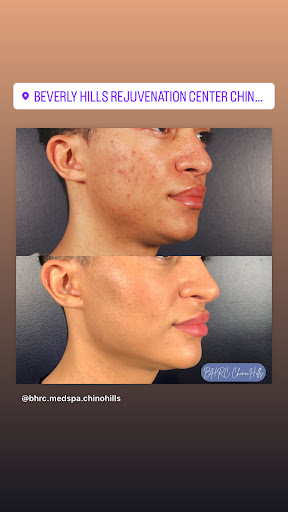 Beverly Hills Rejuvenation Center image