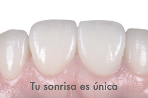 Clínica Dental MiBO Almería image