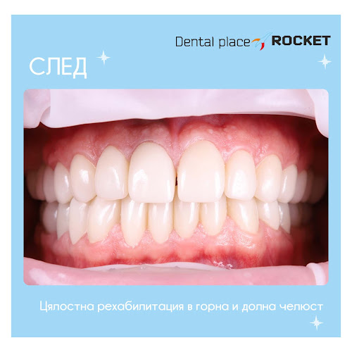 Стоматологичен кабинет Габрово “Rocket”/ Dental cabinet Gabrovo - Зъболекар