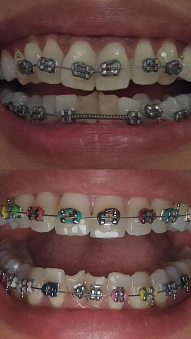 Bite Solutions Dental Clinic - Bite Solutions Dental Clinic