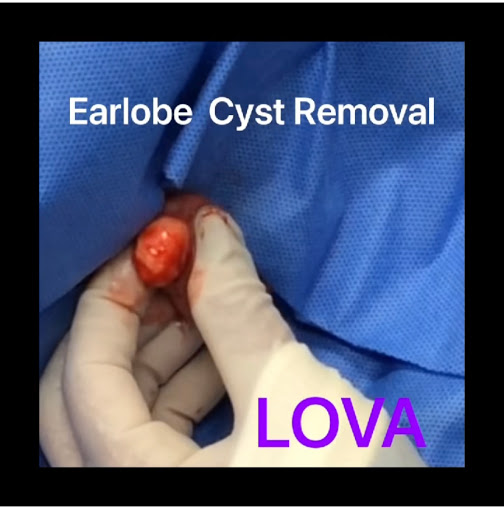 Find sexy tattoo ideas women for your next unique tattoo in Lake Oswego at Lake Oswego Vein and Aesthetic LOVA