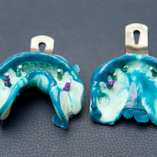 National Periodontics -Hervey Bay QLD - National Periodontics -Hervey Bay QLD