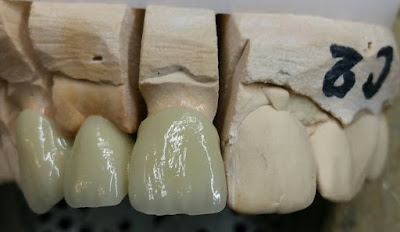 Sarl Prothese Dental Concept à Caluire-et-Cuire