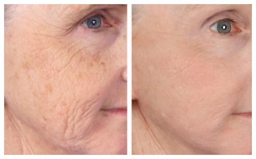 Find dino tattoo ideas for your next unique tattoo in Englewood at Laser Remedy Skin Solutions