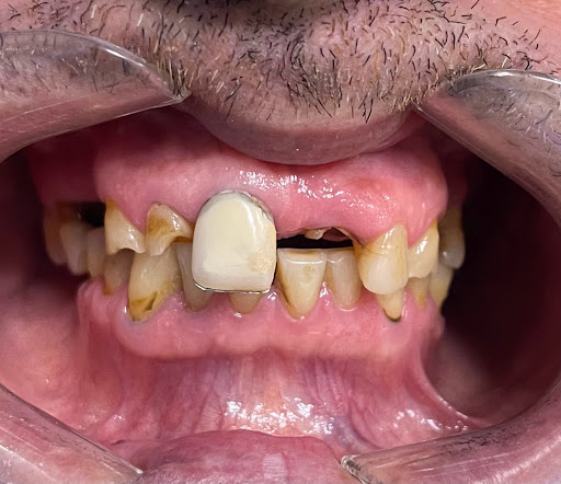 Super Dentist Miami Photo