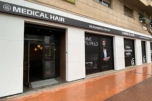 Medical Hair Murcia | Clinica Capilar en Murcia ⭐⭐⭐⭐️⭐️ image