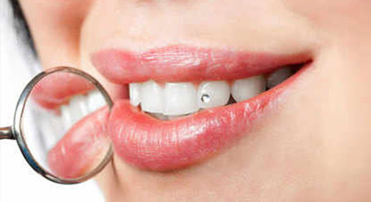 PlanDental - Dentistry Done Right. Dental Clinic, Mahim - PlanDental - Dentistry Done Right. Dental Clinic, Mahim