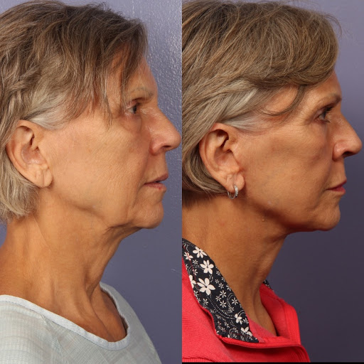 Dr. Gould Plastic Surgery image