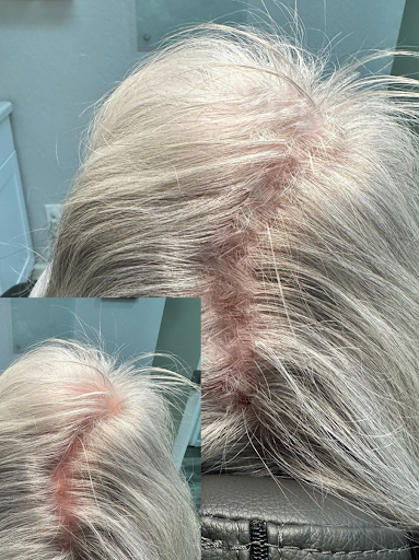 Explore flower ankle tattoo ideas, creative tattoo ideas in Roseville, available at NuHair Ink. Scalp MicroPigmentation & Aesthetic Clinic of Sacramento