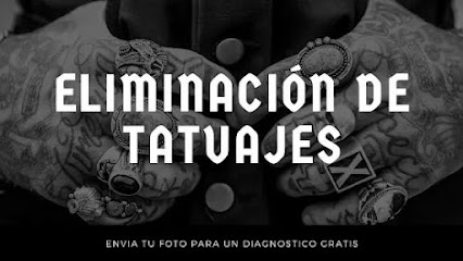 QuitaTattoo - Eliminación de Tatuajes Con Láser - Playa Del Carmen