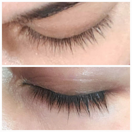 Explore chronic pain tattoo ideas, creative tattoo ideas in Chino, available at SoCal Body Institute