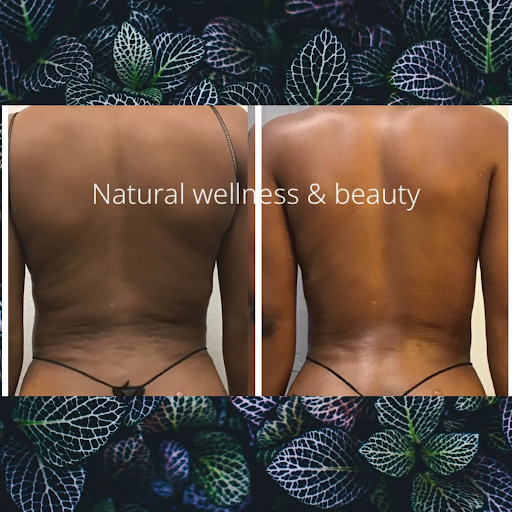 Natural Wellness & Beauty LLC- Lymphatic Drainage-Post Op- Fajas & Weight Loss