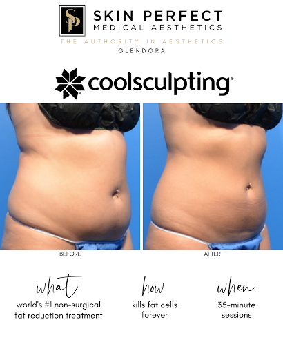 Skin Perfect Medical Aesthetics - Glendora image