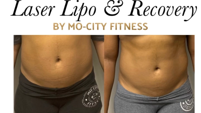 Lipo Laser & Recovery by Mo-City Fitness 77477