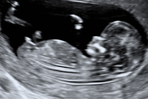Ultrasound Partners image
