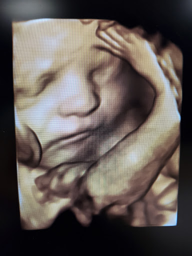Baby Wave 4D Ultrasound image