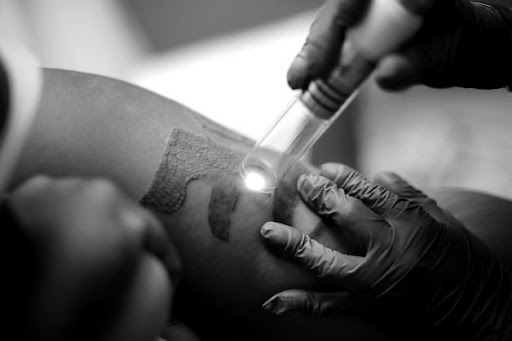 Explore 3 sibling tattoo ideas, creative tattoo ideas in San Jose, available at New Skin Tattoo Removal