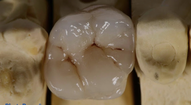 Οδοντοτεχνικό Εργαστήριο G.R. Dental Lab - Εργαστήριο